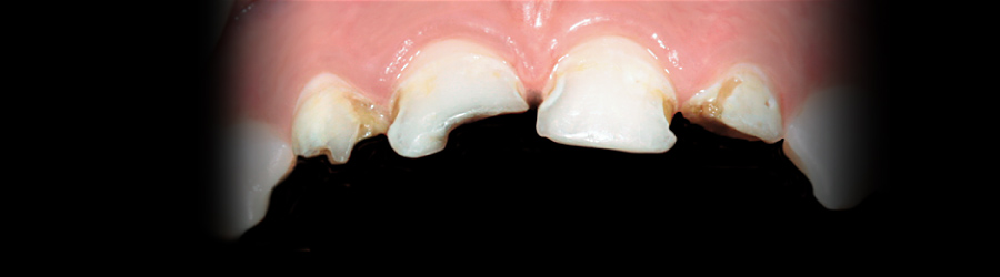 Стиль дент лечение зубов под наркозом цены thumbnail