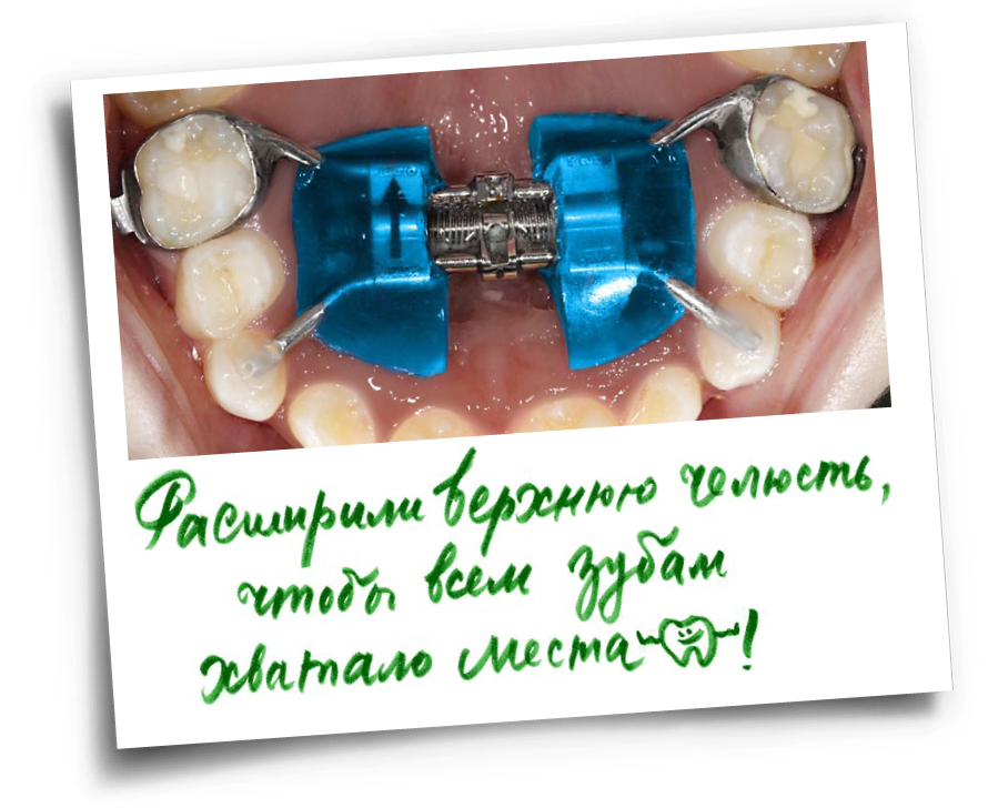 Карточки_Йонас_деск2.png